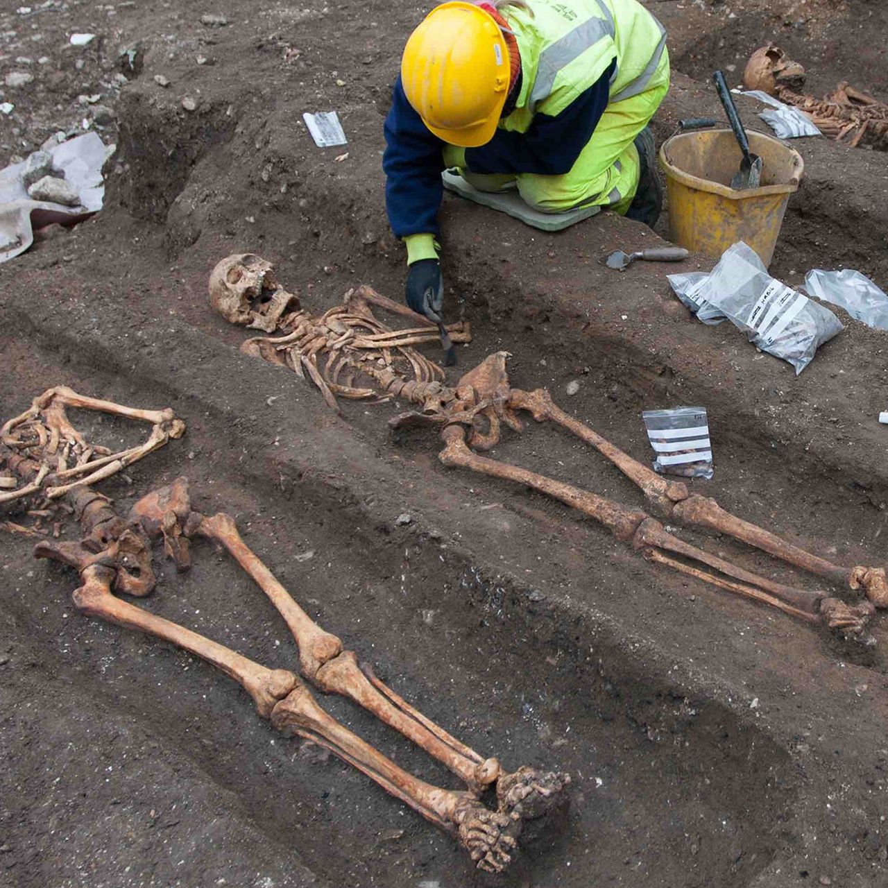 Why Were Medieval Monks So Susceptible to Intestinal Worms?, image size:1280x1280