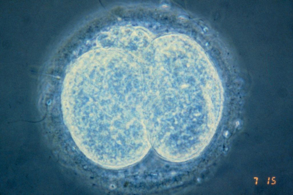 Human embryo