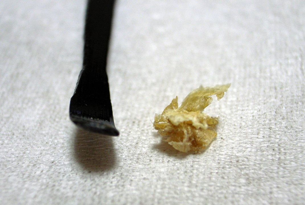 What Does Your Earwax Smell Like? Smart News Smithsonian Magazine