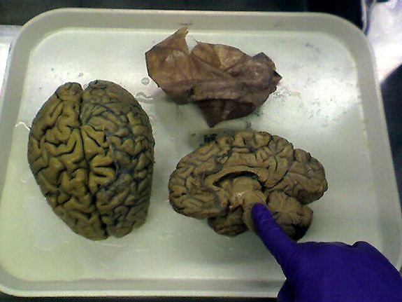 2012082310300608_23_2012_brain-half.jpg