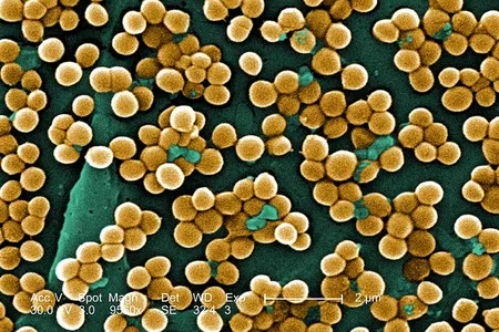 Methicillin-resistant Staphylococcus aureus