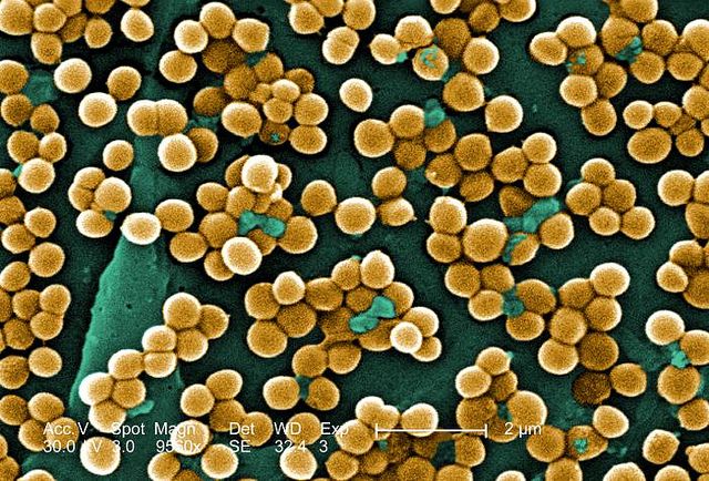 Methicillin-resistant Staphylococcus aureus