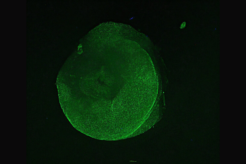 a green blob on a dark background
