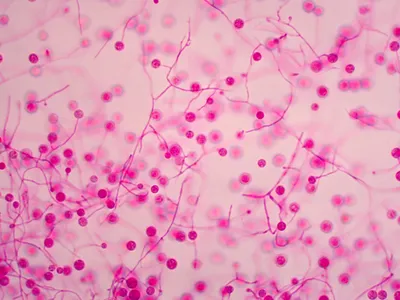 Histoplasma under a microscope