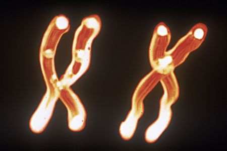 Most individuals born male have an X and a Y chromosome, while those born female have two X chromosomes.&nbsp;