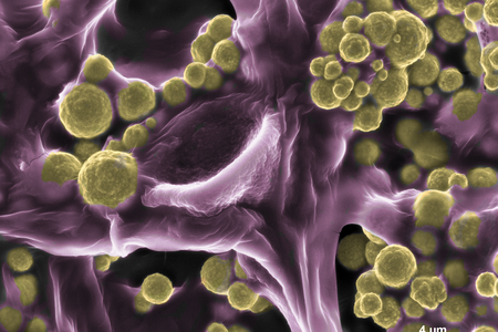 The fungus picks up gold from its surroundings, oxidizes it, and then transforms the dissolved element back into a solid state