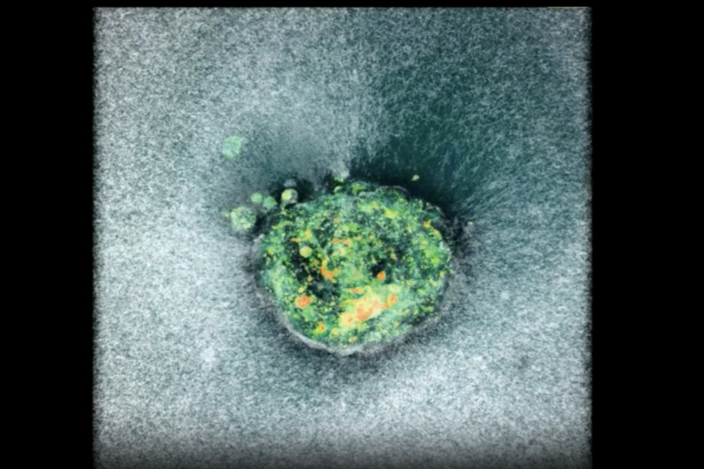 A human embryo embedding itself into the fake uterus.