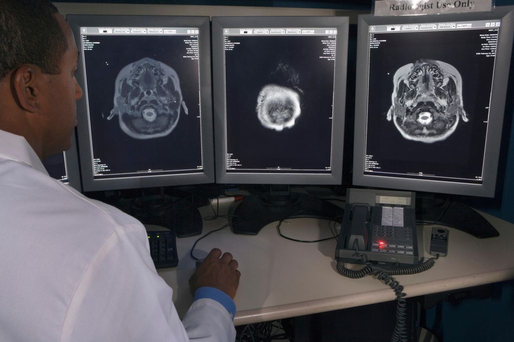 Brain Scans