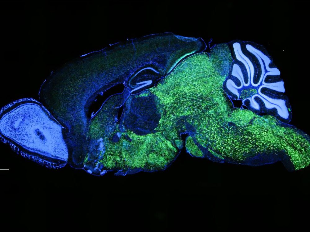 Expression pattern of NOVA1 in the brain of a mouse. NOVA1 in green, nuclei (DAPI) in blue.