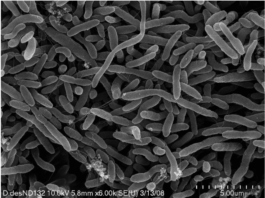 Black and white microscopic image showing worm-like strands of bacteria