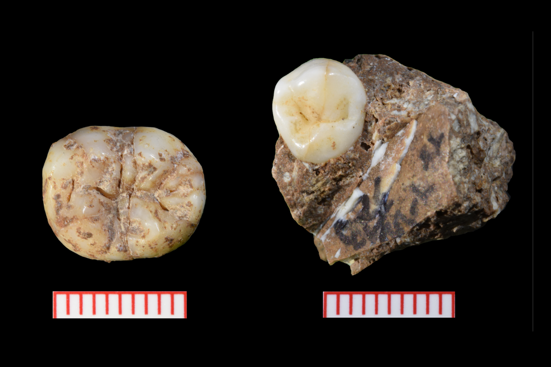 two teeth on a black background