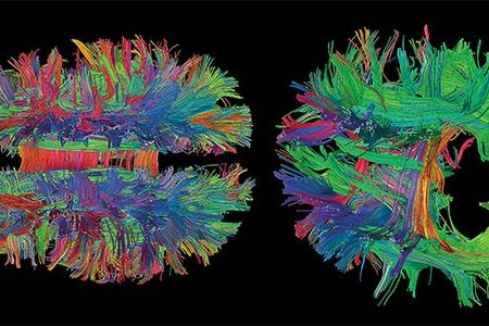 Under the right conditions, patterns emerge from the brain's monumental complexity.