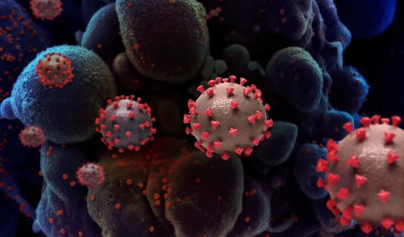 An artistic representation of SARS-CoV-2, the virus that causes COVID-19. (NIAID)