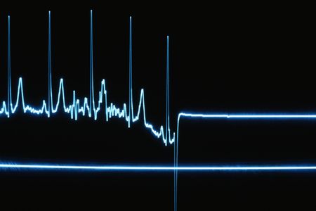 Flatline on a heart monitor