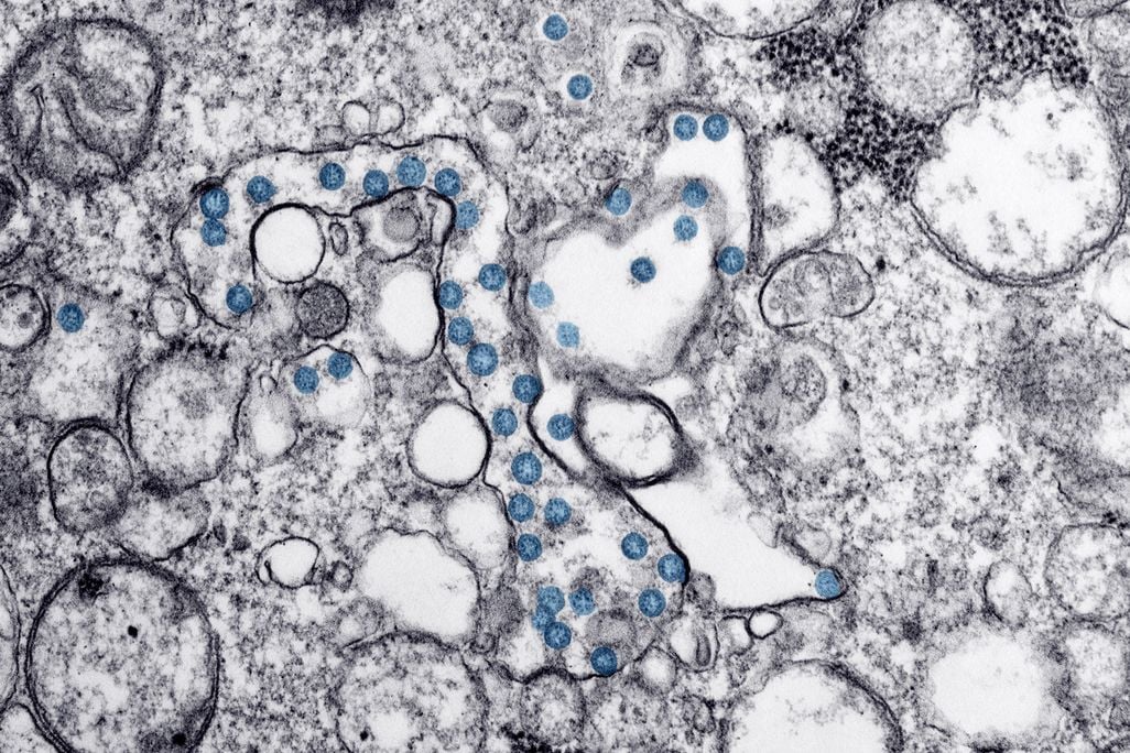 Microscope image of an isolate from the first U.S. case of Covid-19.