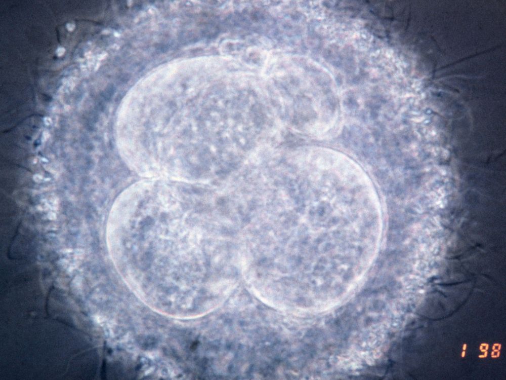 human embryo