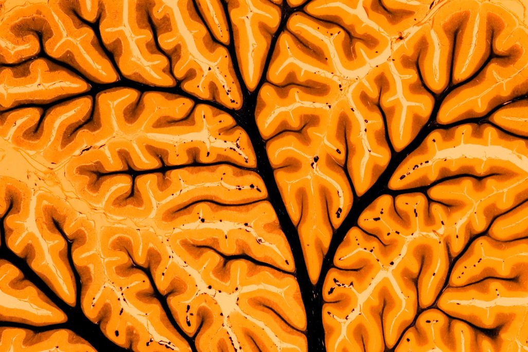 brain stimulation.jpg
