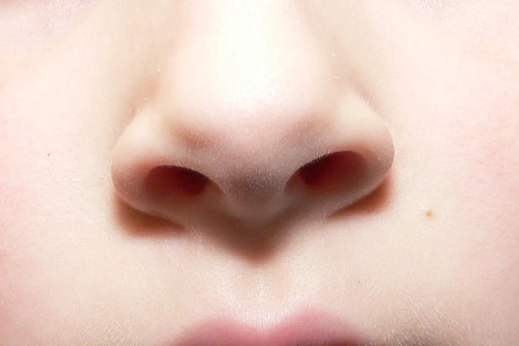 Nose