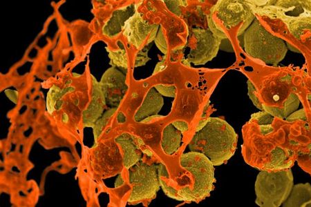 Drug-resistant MRSA bacteria