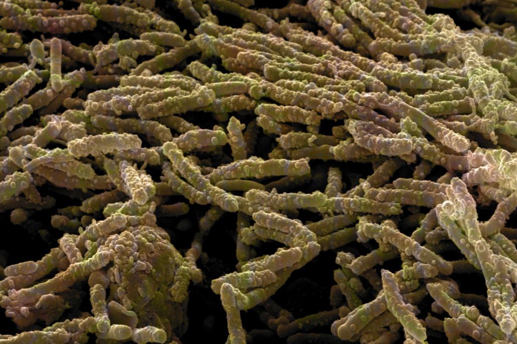 ecoli