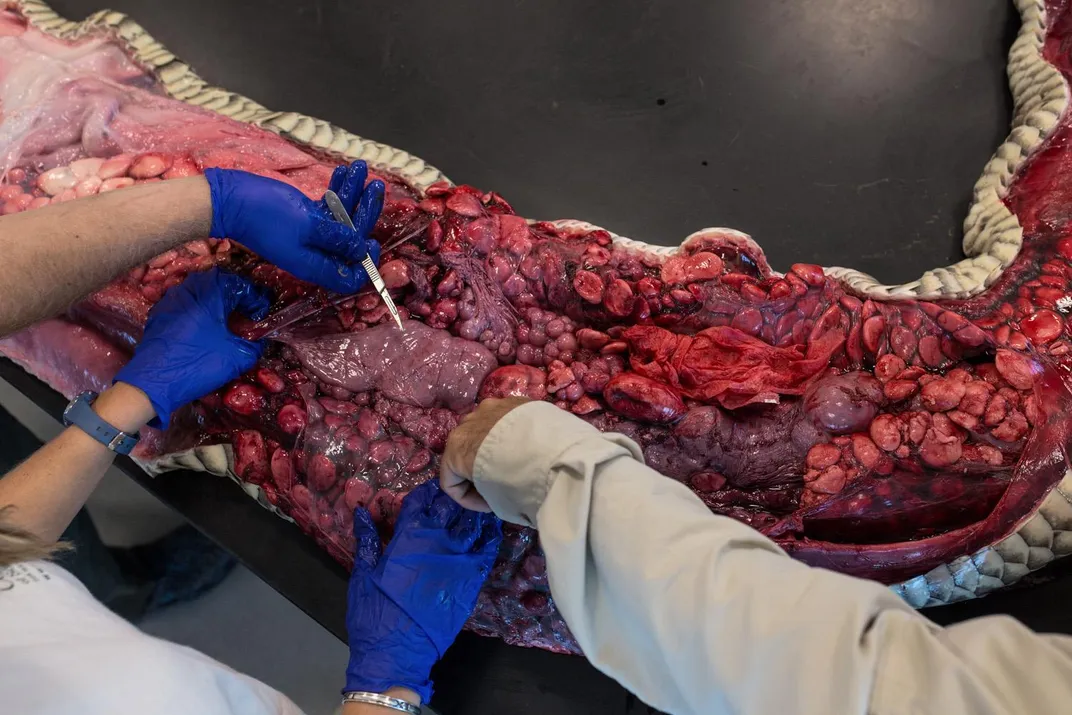 digestive tract