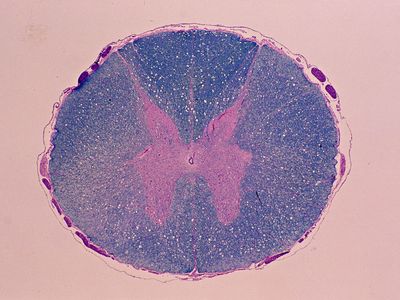 A cross-section of a spinal cord at five times magnification.