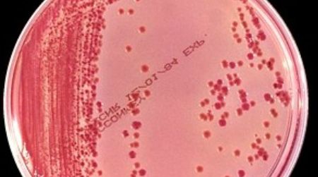 The superbug behind a deadly outbreak