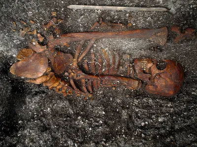 DNA From 2,000-Year-Old Skeletons Hints at the Origins of Syphilis image