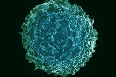 An artificially colored human&nbsp;B cell, the type of immune cell that caused all three autoimmune diseases in the patient