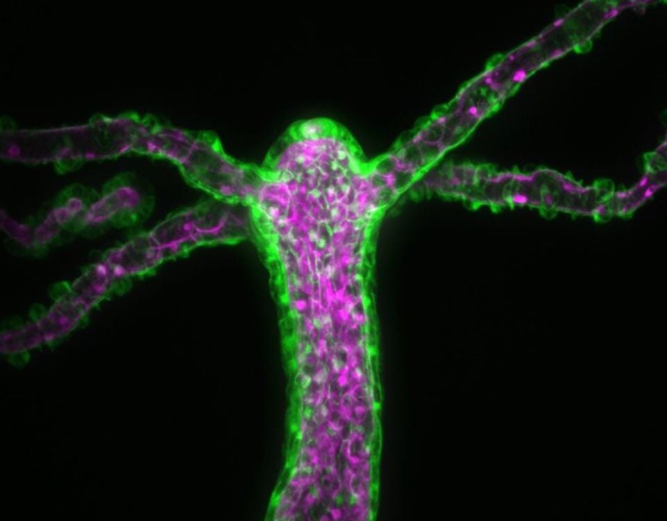 Transgenic Hydra