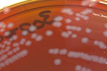 A gonorrhea culture