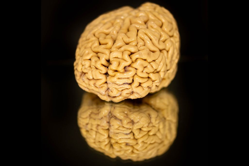 a brain on a black background