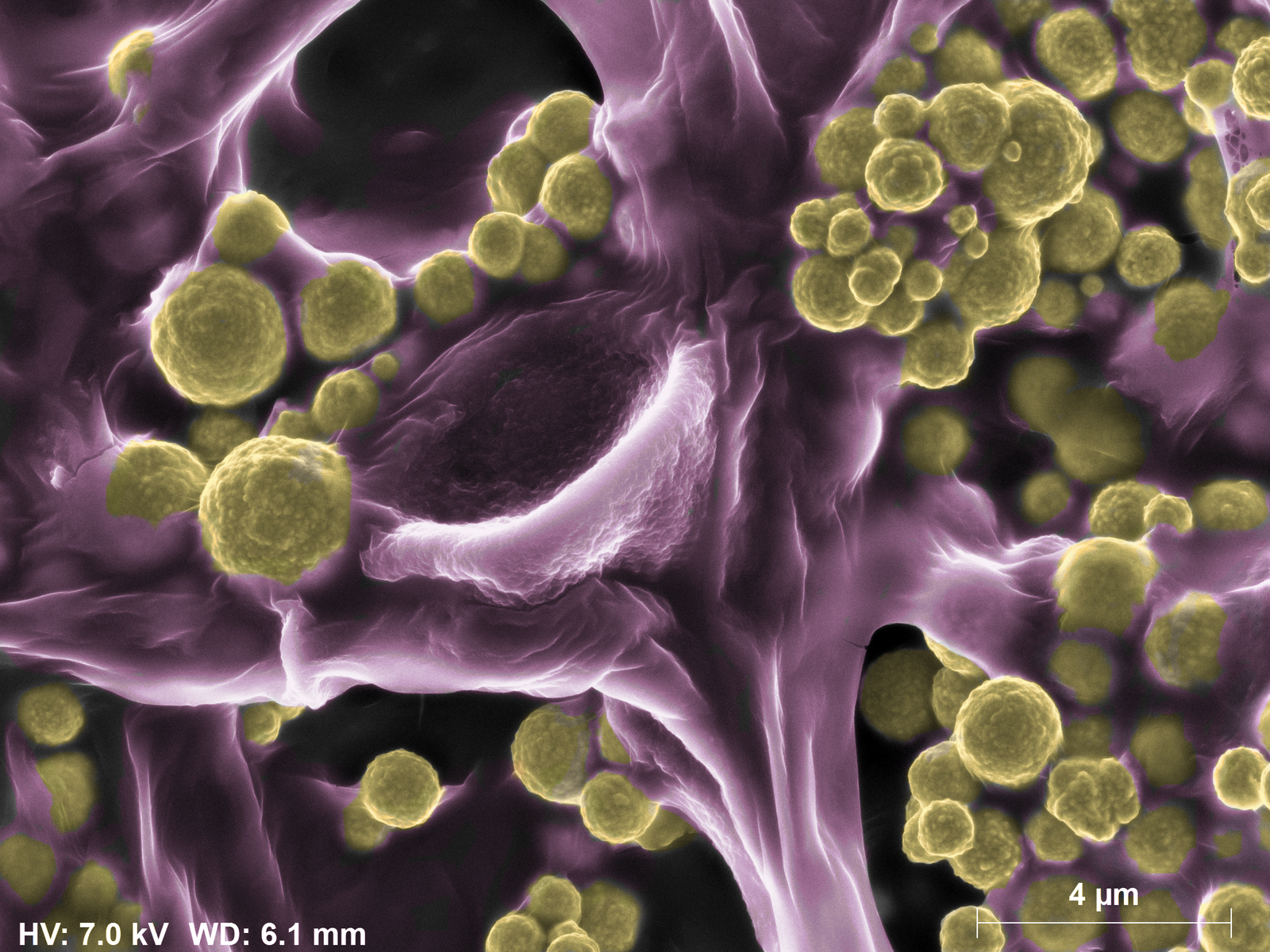 Gold-digging bacterium makes precious particles