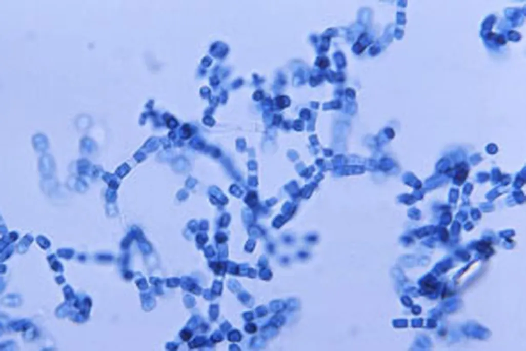 Coccidioides immitis spores