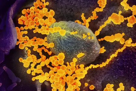A scanning electron microscope image of SARS-CoV-2, the coronavirus that causes COVID-19.