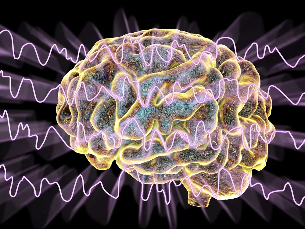 Computer illustration of a brain and brain waves