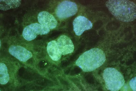 An image of stem cells on a computer screen from 2010. Stem cells have the potential to develop into various types of cells.