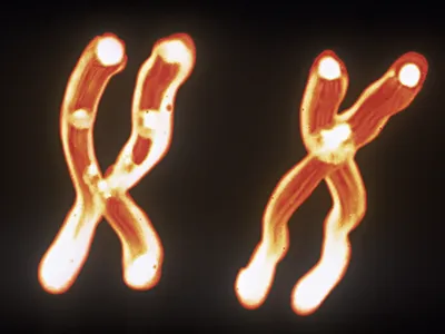 Most individuals born male have an X and a Y chromosome, while those born female have two X chromosomes.&nbsp;