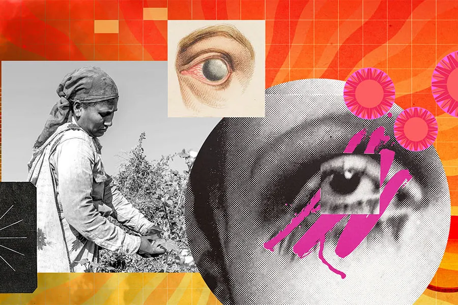 Eye Disorders Illustration