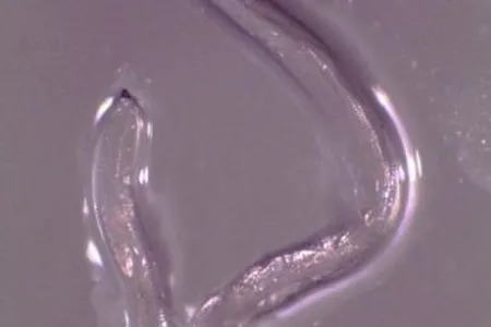 Eye worm extracted from Beckley
