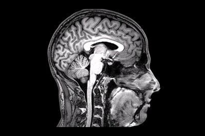 An fMRI scan of a human head in black and white. The scan is of a person's profile, facing the right edge of the photo. The scan highlights all the different organs in the head, like the brain, brain stem, mouth and nose. 