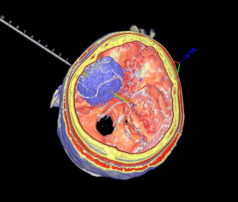 How Is Brain Surgery Like Flying? Put On a Headset to Find Out