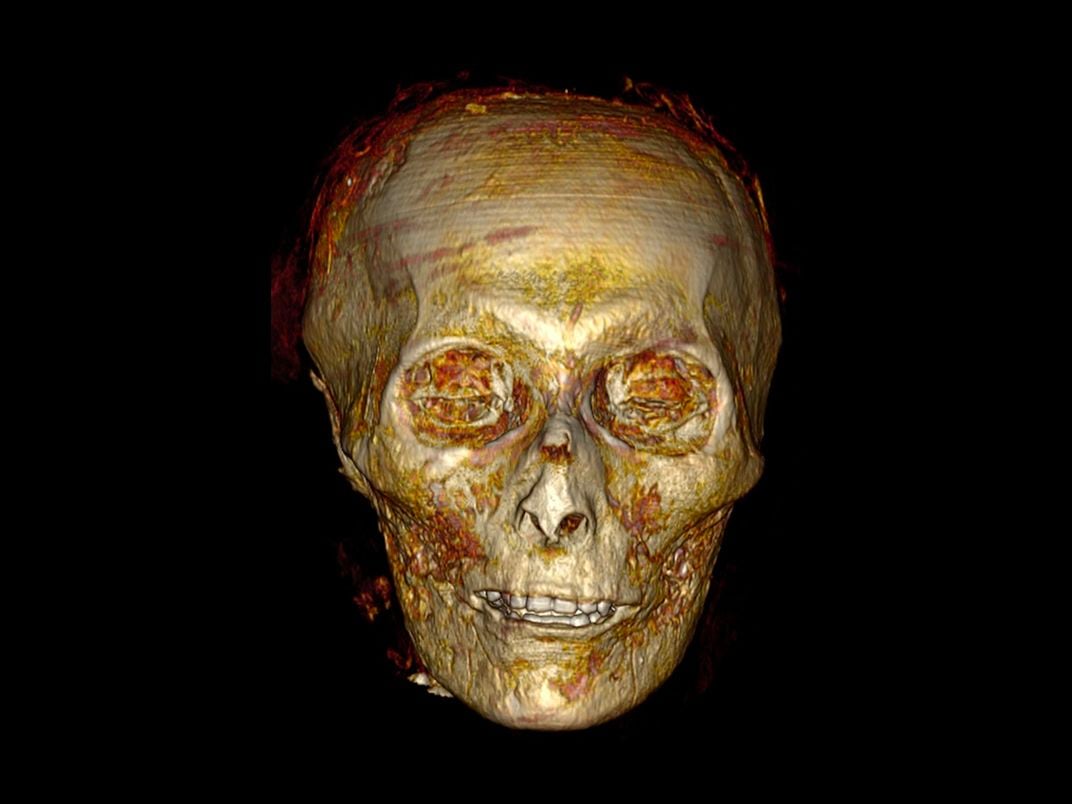 3-D scan of skull
