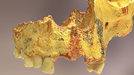A partial Homo antecessor skull that was unearthed at the Gran Dolina cave site in the Atapuerca Mountains of  Spain.