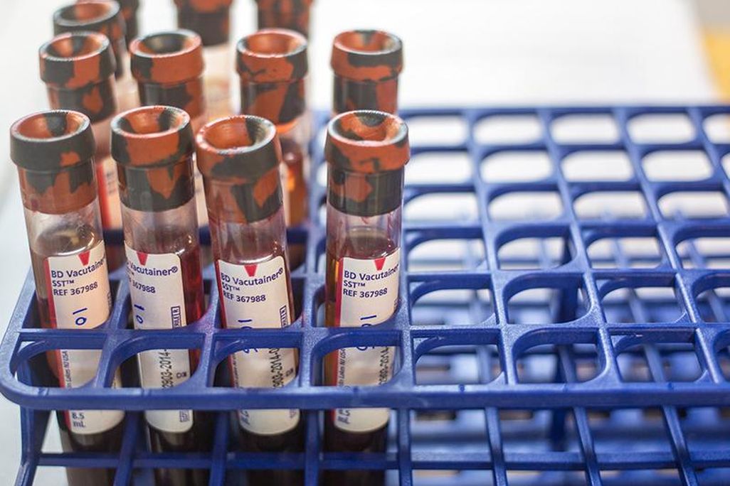 Blood Samples
