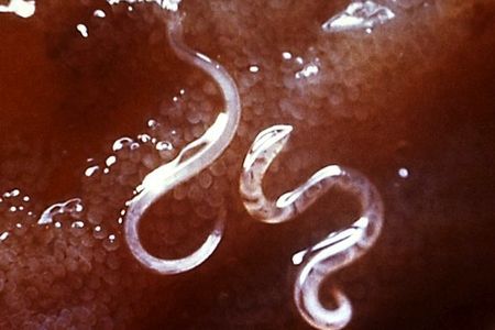 Parasitic hookworms in a person’s intestinal lining.