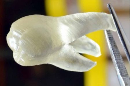 This 3D printed tooth could kill germs in your mouth