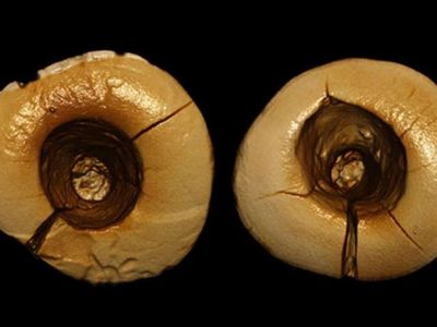 Computer-assisted reconstruction of the cavities