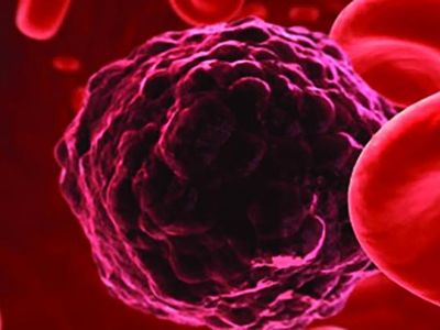 Scientists are able to detect the DNA of tumor cells floating in blood.
