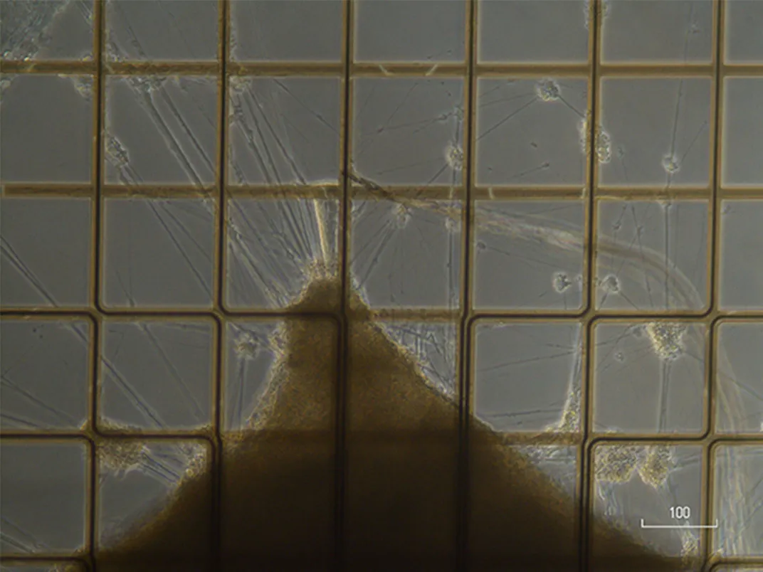 Cerebral organoids